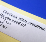  בדיקת סיסי שליה או דיקור מי שפיר?-תמונה